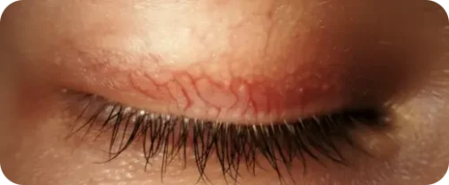 demoxoft-plus-clean-6